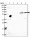 Zinc Finger Protein 584 antibody, NBP2-47564, Novus Biologicals, Western Blot image 