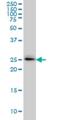 SPRY domain-containing SOCS box protein 2 antibody, H00084727-M01, Novus Biologicals, Western Blot image 