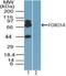 Forkhead Box O1 antibody, NBP2-24857, Novus Biologicals, Western Blot image 