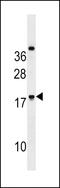 Ring Finger Protein 224 antibody, 60-281, ProSci, Western Blot image 