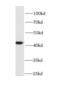 Hydroxyacid oxidase 1 antibody, FNab03752, FineTest, Western Blot image 