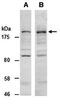 Lysine Demethylase 6A antibody, orb66980, Biorbyt, Western Blot image 