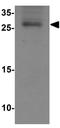 RAB21, Member RAS Oncogene Family antibody, GTX17174, GeneTex, Western Blot image 