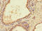 Pentatricopeptide Repeat Domain 2 antibody, orb35013, Biorbyt, Immunohistochemistry paraffin image 