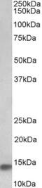 NADH:Ubiquinone Oxidoreductase Subunit A7 antibody, NBP2-26162, Novus Biologicals, Western Blot image 