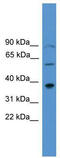 Paired Like Homeodomain 1 antibody, TA330258, Origene, Western Blot image 