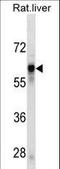 SERPINC1 antibody, LS-C158949, Lifespan Biosciences, Western Blot image 