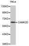 Calcium/Calmodulin Dependent Protein Kinase II Delta antibody, abx000799, Abbexa, Western Blot image 
