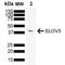 ELOVL Fatty Acid Elongase 3 antibody, NBP2-76673, Novus Biologicals, Western Blot image 