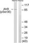 Aryl Hydrocarbon Receptor antibody, TA313163, Origene, Western Blot image 