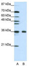 rRNA 2 -O-methyltransferase fibrillarin antibody, TA345779, Origene, Western Blot image 