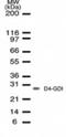 Rho GDP Dissociation Inhibitor Beta antibody, NB100-56556, Novus Biologicals, Western Blot image 
