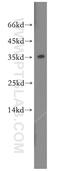 Sulfotransferase 1A3/1A4 antibody, 19499-1-AP, Proteintech Group, Western Blot image 