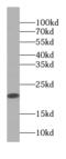 Peptidylprolyl Isomerase F antibody, FNab06676, FineTest, Western Blot image 