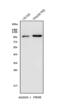 PDE6B antibody, A02659-1, Boster Biological Technology, Western Blot image 
