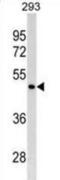 GATA Binding Protein 4 antibody, abx025481, Abbexa, Western Blot image 