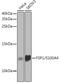 S100 Calcium Binding Protein A4 antibody, GTX32855, GeneTex, Western Blot image 