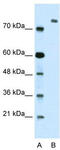 Zinc Finger MYM-Type Containing 3 antibody, TA335723, Origene, Western Blot image 