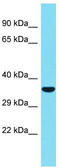 Complement C1q Like 2 antibody, TA331546, Origene, Western Blot image 