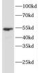 Keratin 7 antibody, FNab02218, FineTest, Western Blot image 