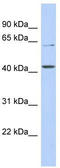 Solute carrier family 22 member 12 antibody, TA333516, Origene, Western Blot image 