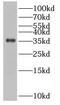 Sulfotransferase Family 1B Member 1 antibody, FNab08380, FineTest, Western Blot image 