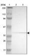 PDZ And LIM Domain 2 antibody, PA5-52009, Invitrogen Antibodies, Western Blot image 