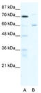 Forkhead Box J2 antibody, TA331860, Origene, Western Blot image 