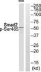 SMAD2 antibody, TA312261, Origene, Western Blot image 