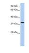 Family With Sequence Similarity 216 Member A antibody, NBP1-56675, Novus Biologicals, Western Blot image 