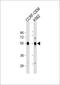 Galanin Receptor 1 antibody, 63-904, ProSci, Western Blot image 