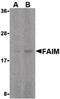 Fas apoptotic inhibitory molecule 1 antibody, LS-C19449, Lifespan Biosciences, Western Blot image 