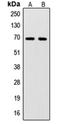 Sentrin-specific protease 2 antibody, orb215252, Biorbyt, Western Blot image 