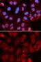Recombination Activating 2 antibody, GTX54683, GeneTex, Immunofluorescence image 
