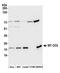 Mitochondrially Encoded Cytochrome C Oxidase II antibody, A305-318A, Bethyl Labs, Western Blot image 