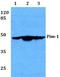 Pim-1 Proto-Oncogene, Serine/Threonine Kinase antibody, A01184, Boster Biological Technology, Western Blot image 