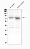 Arachidonate 12-lipoxygenase, 12S-type antibody, A02275-1, Boster Biological Technology, Western Blot image 