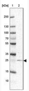 Regulating Synaptic Membrane Exocytosis 4 antibody, NBP2-31842, Novus Biologicals, Western Blot image 
