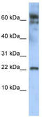 LDOC1 Regulator Of NFKB Signaling antibody, TA343696, Origene, Western Blot image 