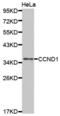 Cyclin D1 antibody, abx001183, Abbexa, Western Blot image 
