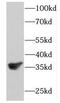 FKBP Prolyl Isomerase 6 antibody, FNab03147, FineTest, Western Blot image 