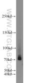 UTP4 Small Subunit Processome Component antibody, 11057-1-AP, Proteintech Group, Western Blot image 