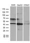 F-Box Protein 22 antibody, M09447, Boster Biological Technology, Western Blot image 