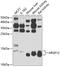 Ribonuclease UK114 antibody, GTX64987, GeneTex, Western Blot image 