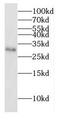 DnaJ Heat Shock Protein Family (Hsp40) Member C4 antibody, FNab02466, FineTest, Western Blot image 
