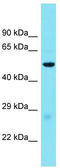 Glucagon-like peptide 1 receptor antibody, TA338011, Origene, Western Blot image 