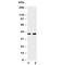 Baculoviral IAP Repeat Containing 7 antibody, R30498, NSJ Bioreagents, Western Blot image 