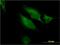 RAB9B, Member RAS Oncogene Family antibody, H00051209-M04, Novus Biologicals, Immunocytochemistry image 