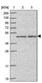 Zinc Finger With KRAB And SCAN Domains 7 antibody, PA5-62087, Invitrogen Antibodies, Western Blot image 