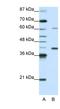 Zinc Finger Protein 843 antibody, NBP1-91549, Novus Biologicals, Western Blot image 
